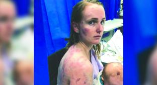 Mujer cubrió con su cuerpo a su bebé del granizo en Australia. Noticias en tiempo real