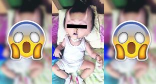 Le salen cuernos a nene tras operación, en Filipinas. Noticias en tiempo real