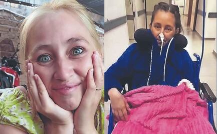 Ciruguía fácil termina en Infartos, amputación y trasplante para una mujer ¿Cómo fue la pesadilla?