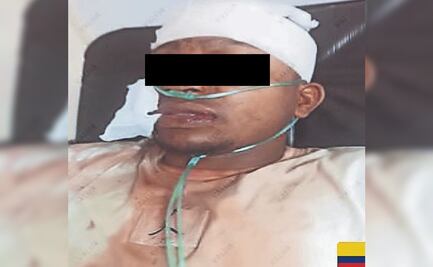 Colombiano se mete con la novia de su jefe y termina baleado en el Centro de la CDMX