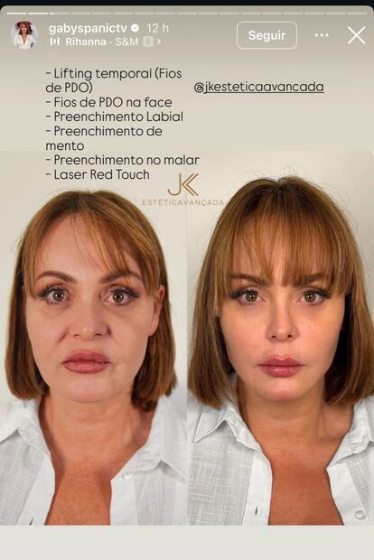 Gaby Spanic antes y después (Foto: Instagram)