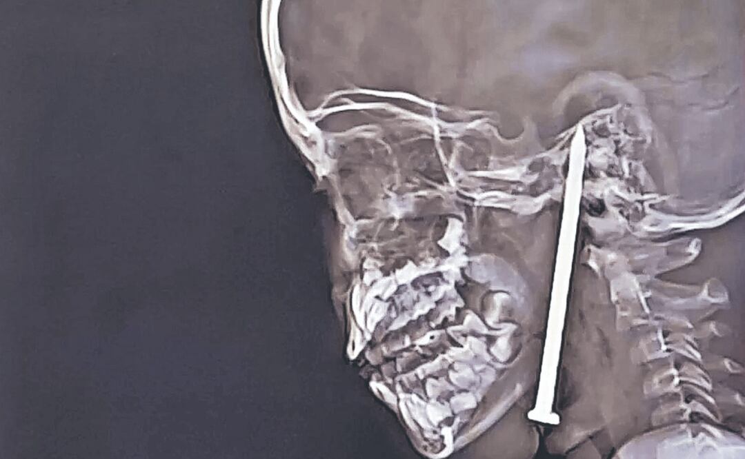 Niña sobrevive a horrible accidente (Foto: Especial)