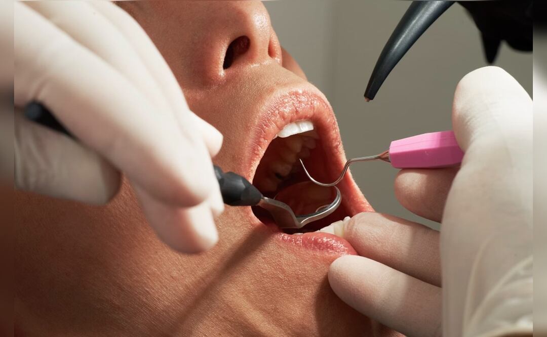 Modelo muere de manera inesperada, tras someterse a cirugía maxilofacial