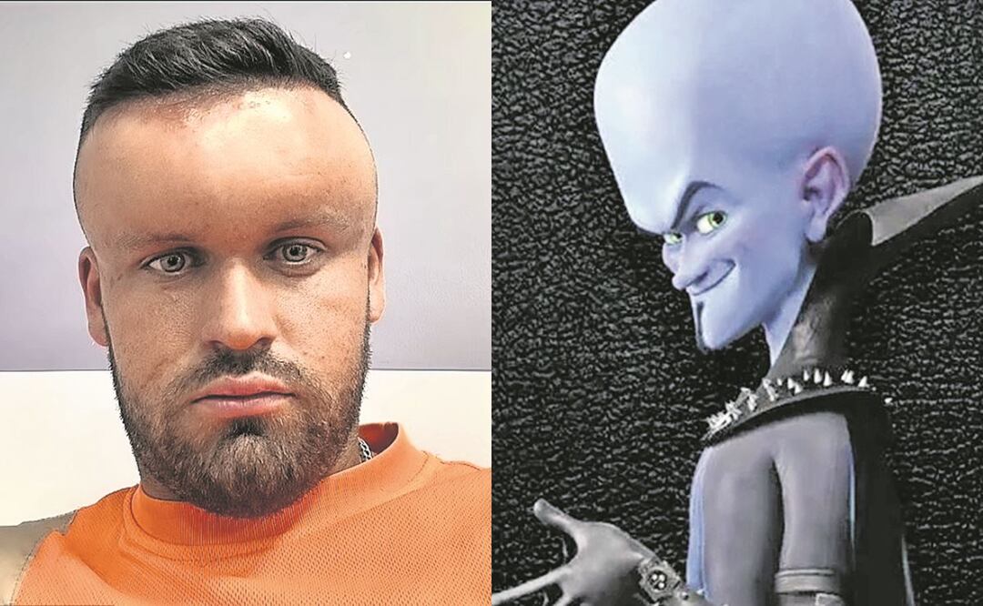 Tinte de cabello hace terrible reacción y deja cabeza de “Megamente”