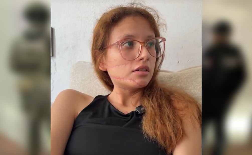 Dejó a su esposa en coma y huyó: Pedro Jared es detenido tras brutal ataque en Ecatepec