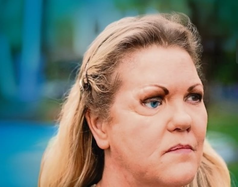 Le arman rostro de rompecabezas a una mujer, tras un accidente en auto. Foto: (Especial)