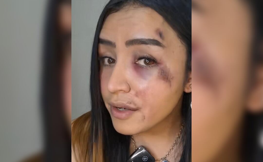 Famosa influencer acepta aventón de un desconocido y termina golpeada por ser trans