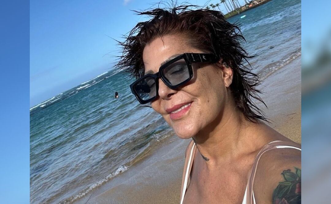 Alejandra Guzmán operada de la mano