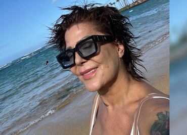 Alejandra Guzmán muestra cicatriz considerable de una cirugía reciente, ¿de qué la operaron?