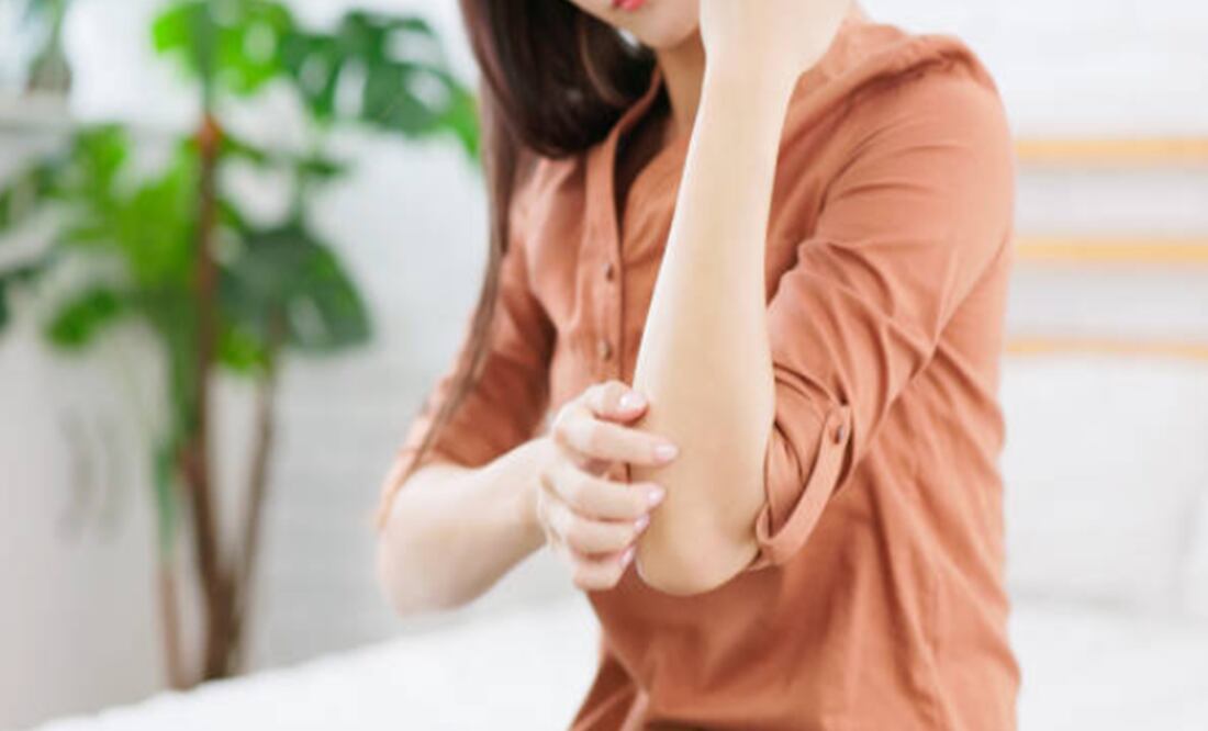 ¡ATENCIÓN! Hay esperanza para pacientes con psoriasis