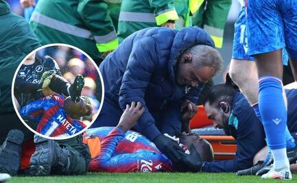 Brutal patada deja inconsciente a Mateta en la FA Cup: requirió 25 puntos de sutura