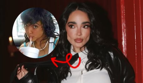 La cirugía más extrema de Manelyk: Fractura de costillas y abdomen esculpido