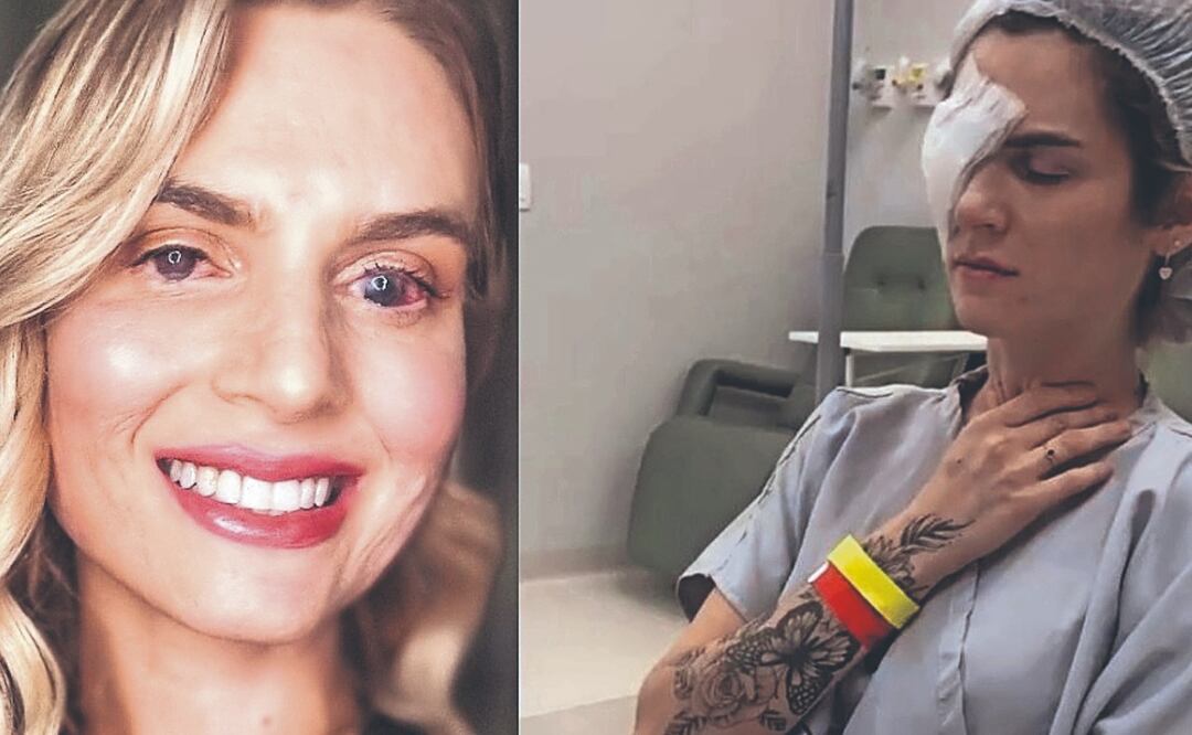 ¡ALERTA! Mujer tomó ibuprofeno y sufrió severas consecuencias, quedó en coma