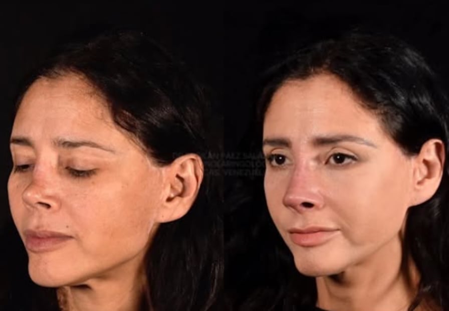 Dorismar, antes y después (Foto: Instagram)