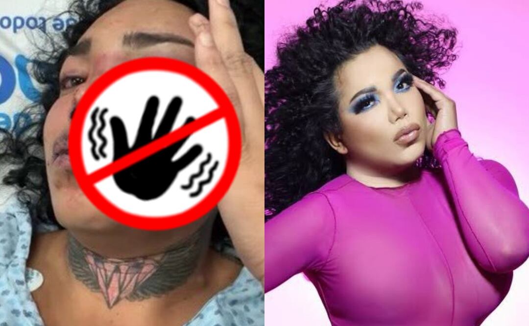 Paola Suárez de 'Las Perdidas': Hospitalizada tras golpiza de su novio, video causa horror