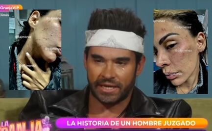 Eleazar Gómez niega en TV abierta haber golpeado a su ex… pero las pruebas lo contradicen