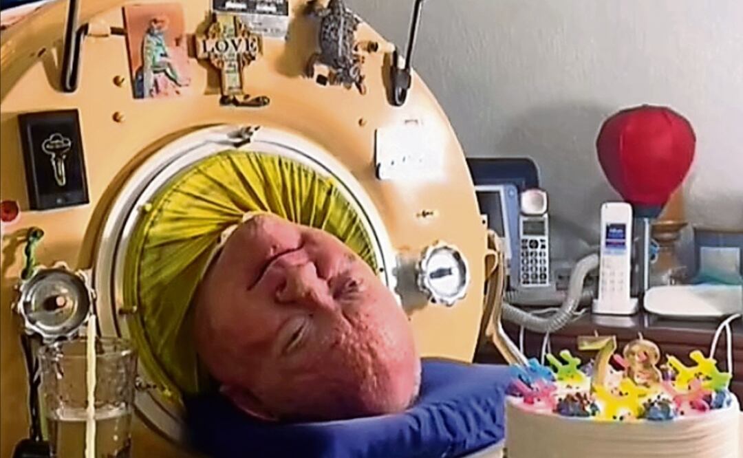 Murió el hombre que habitaba dentro de un “pulmón de hierro”