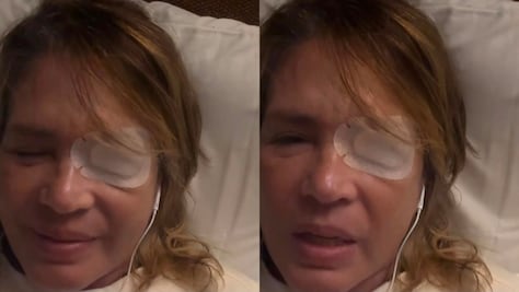 Yolanda Andrade reaparece en redes y causa alerta por parche en el ojo