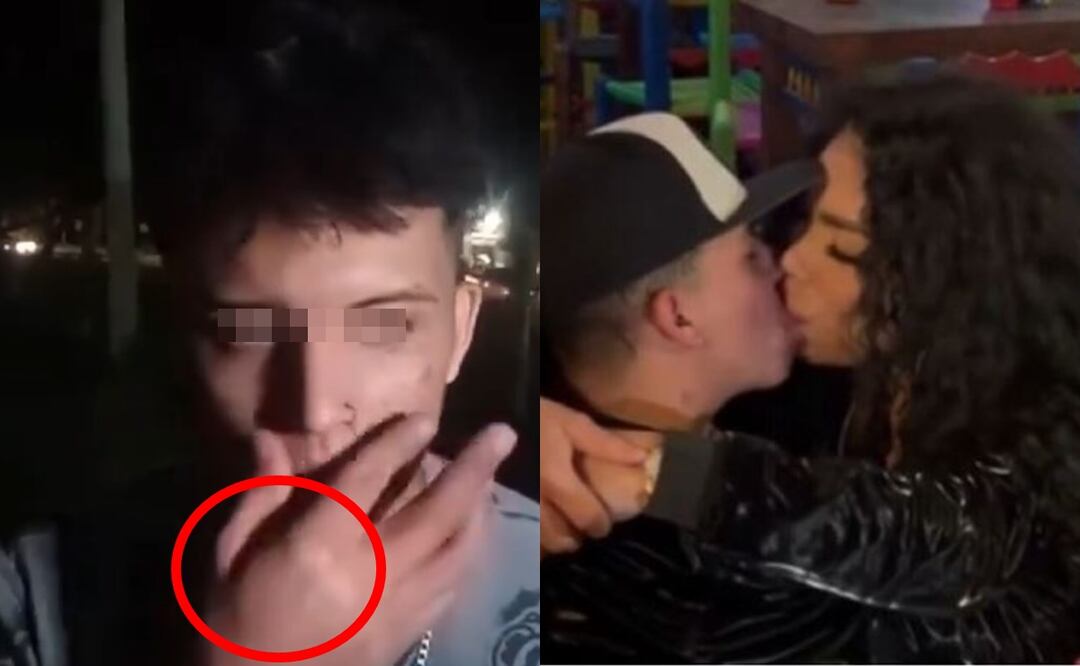 Novio de Paola Suárez niega haberle dado brutal golpiza, pero mano hinchada levanta sospechas