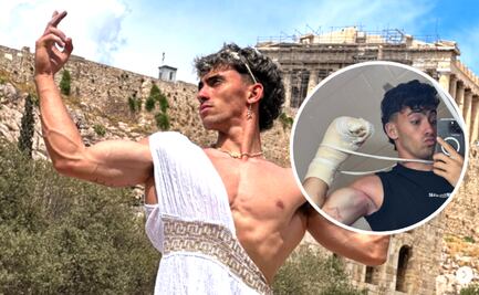 Gero Arias, influencer argentino pierde dos dedos de la mano ¿cómo ocurrió el hecho?