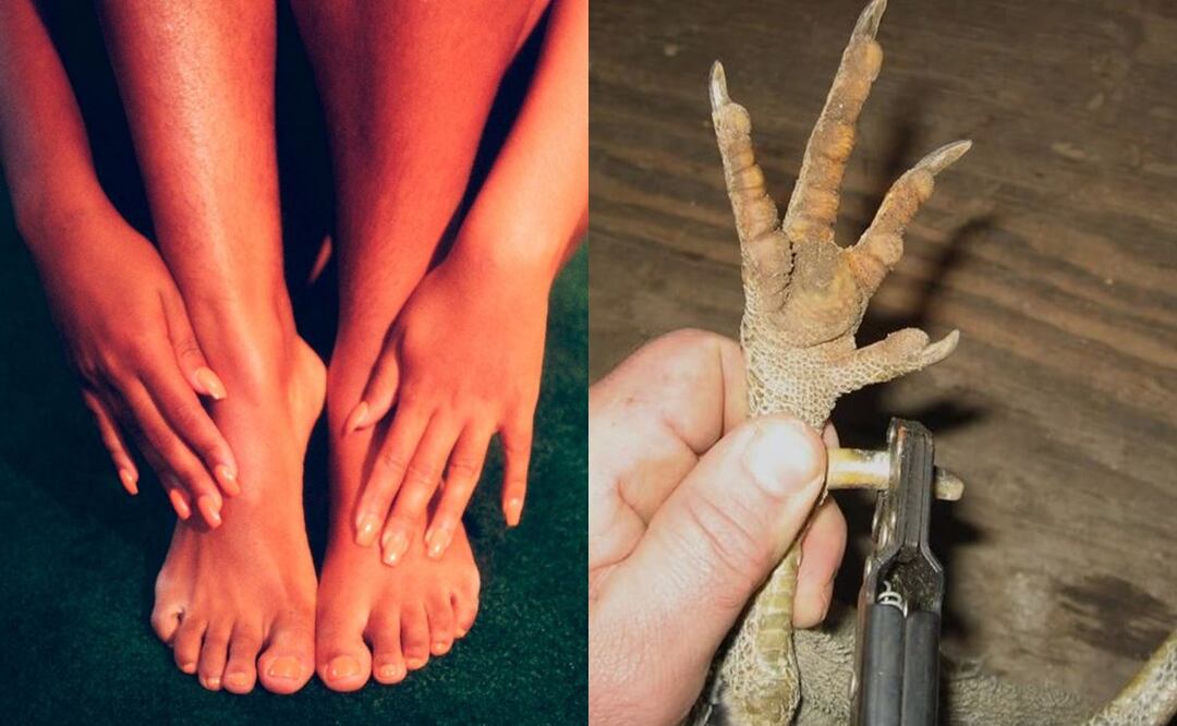 ¿Te sientes muy gallo? Mejor evita los molestos espolones