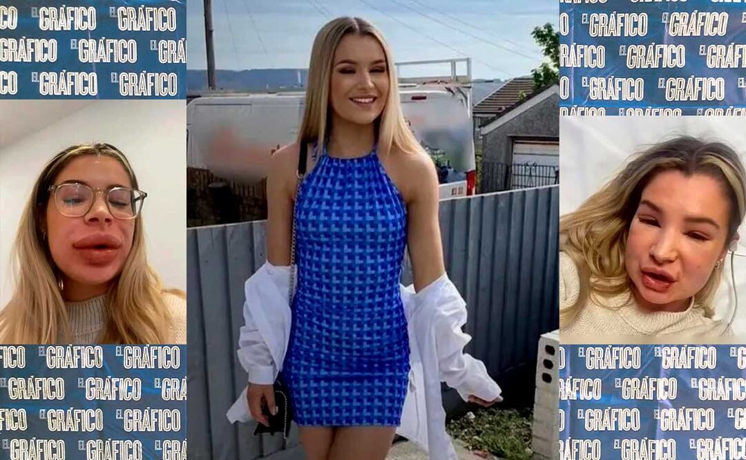 Su rostro quedó desfigurado