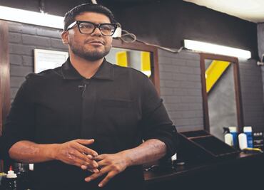 Juan Luis se quemó el brazo en explosión de pipa, sobrevivió y pide que no olviden a las víctimas