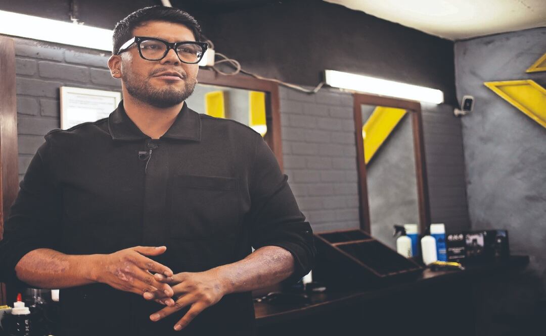 Juan Luis se quemó el brazo en explosión de pipa, sobrevivió y pide que no olviden a las víctimas
Imagen: OSMAR ALVARADO. EL GRÁFICO