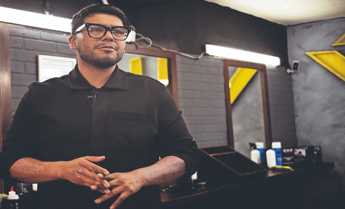 Juan Luis se quemó el brazo en explosión de pipa, sobrevivió y pide que no olviden a las víctimas
Imagen: OSMAR ALVARADO. EL GRÁFICO