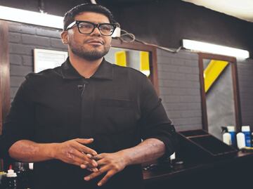 Juan Luis se quemó el brazo en explosión de pipa, sobrevivió y pide que no olviden a las víctimas