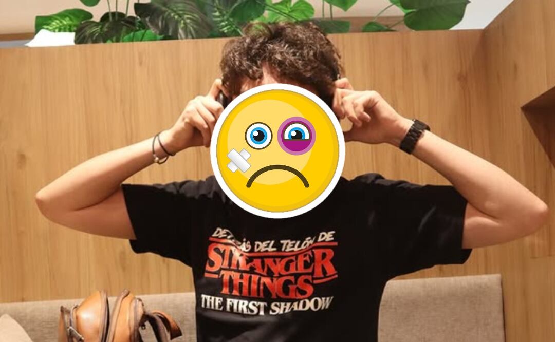 Actor golpeado (Foto: Instagram)