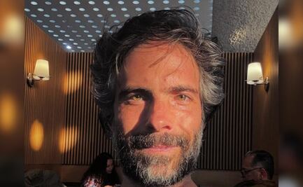 Osvaldo Benavides “Nandito”, sufre picadura de insecto venenoso y queda irreconocible