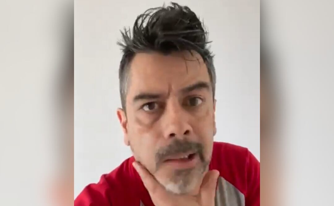Foto: Especiales (Carlos Espejel “Chiquidracula” sufre parálisis facial ¿cuál es su estado de salud?)