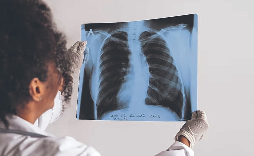 Mujer australiana tenía 5 órganos extras ¿cuál es la razón detrás de esto?