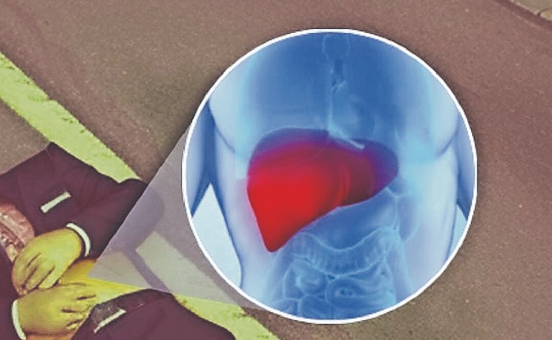 A batazos revientan hígado con cirrosis en Iztapalapa, hombre murió en hospital