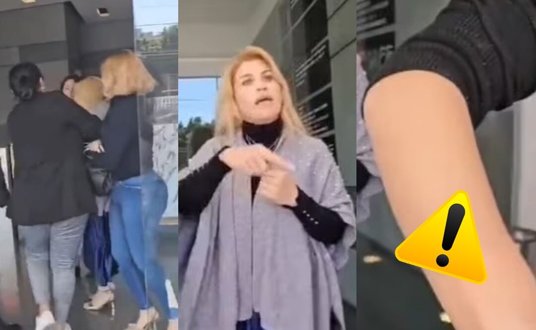 Surge en redes 'Lady Mordidas', agredió a empleadas para no pagar manicure en Edomex