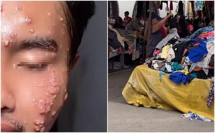 Influencer contrae virus contagioso por comprar ropa de paca ¿cómo lavarla para que no te pase igual? 