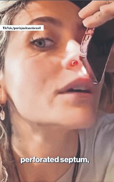 Paris Jackson enseña el hoyito que le quedó tras consumir sustancias ilegales. Foto: (Redes Sociales)