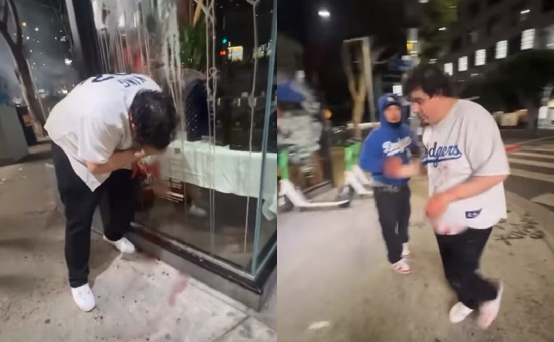 VIDEO: Fanático de los Dodgers pierde la mano en celebración de la Serie Mundial