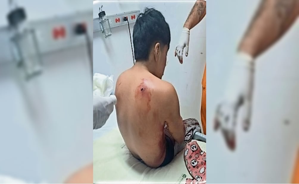 Kevin Uriel N, sufrió heridas en la espalda, otra en el brazo y una más en el pecho. Foto: Especial