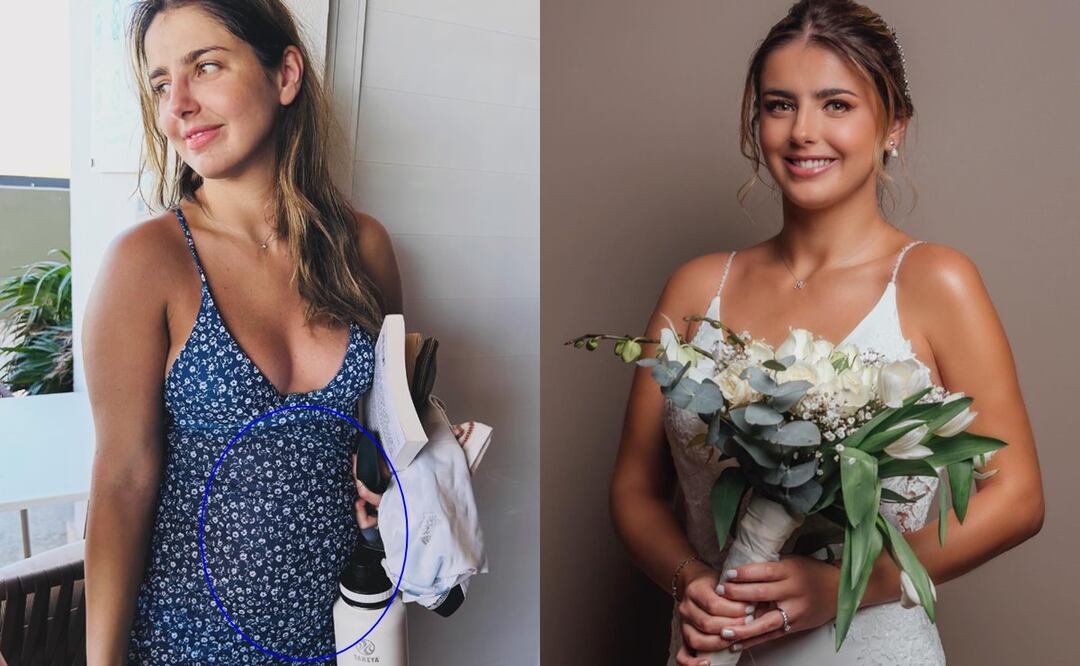 Michelle Renaud lanza fuerte comunicado tras ser cuestionada por supuesta 'colitis' 