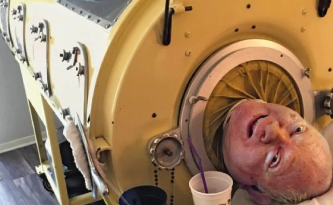 Entierran al hombre del “pulmón de hierro”, con todo y las cenizas de su cuidadora