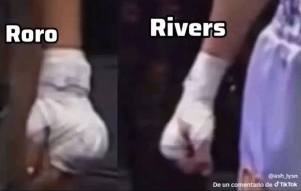Comparación de vendajes entre RoRo y Rivers (Vía: Redes)