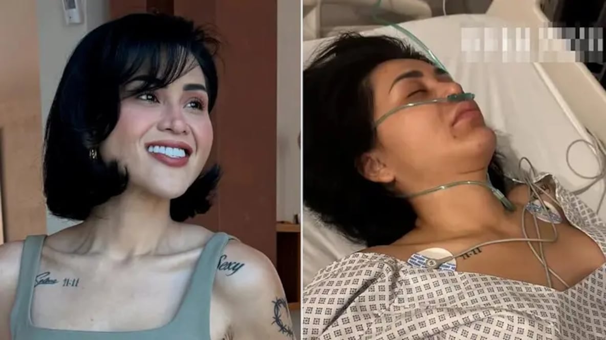 ¡Impactante reaparición! Gomita vuelve tras cirugía de emergencia y preocupa por su aspecto