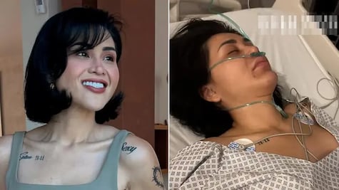 ¡Impactante reaparición! Gomita vuelve tras cirugía de emergencia y preocupa por su aspecto