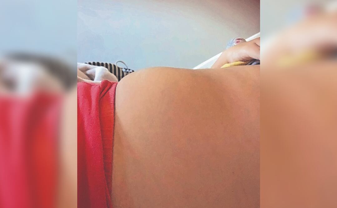 A una niña le creció la panza, creían estaba embarazada y era algo mucho peor