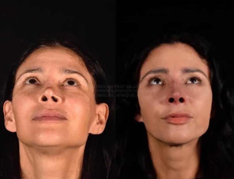 Dorismar, antes y después (Foto: Instagram)