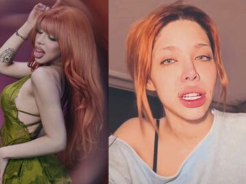 Yeri Mua se somete a doloroso cambio físico tras años de burlas y manda mensaje a sus haters