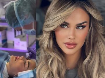 Como Ninel Conde, ¿quieres cambiar tu color de ojos? Esto cuesta la queratopigmentación