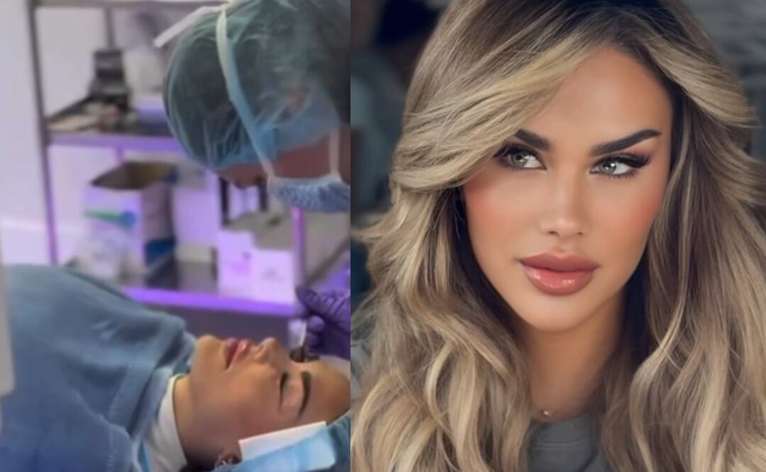 Como Ninel Conde, ¿quieres cambiar tu color de ojos? Esto cuesta la queratopigmentación (Foto: Instagram)